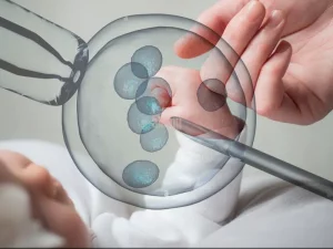 درمان ناباروری با ivf