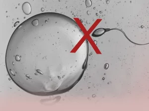 دلایل شکست IVF